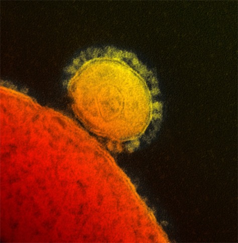 Image: novel coronavirus particle, also known as the MERS virus.